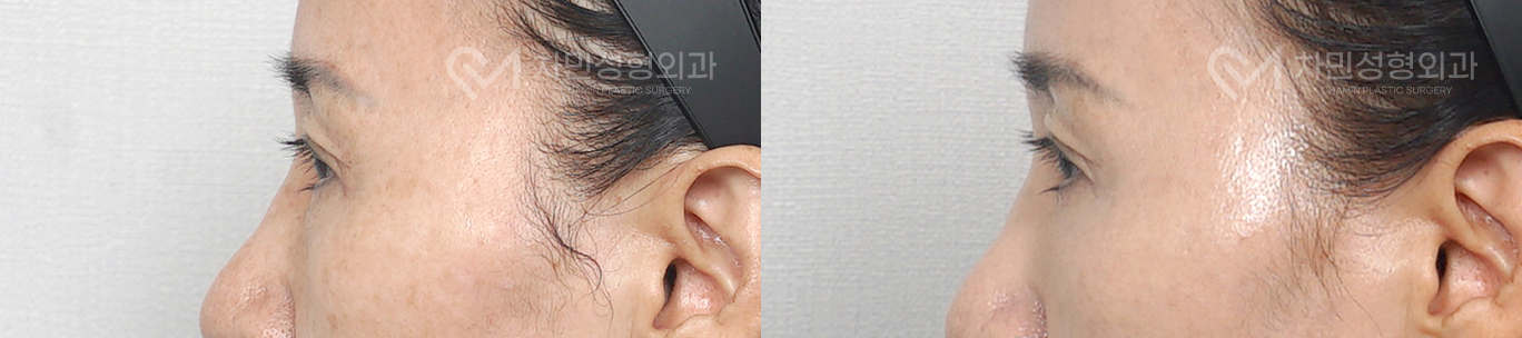 3번째 첨부파일