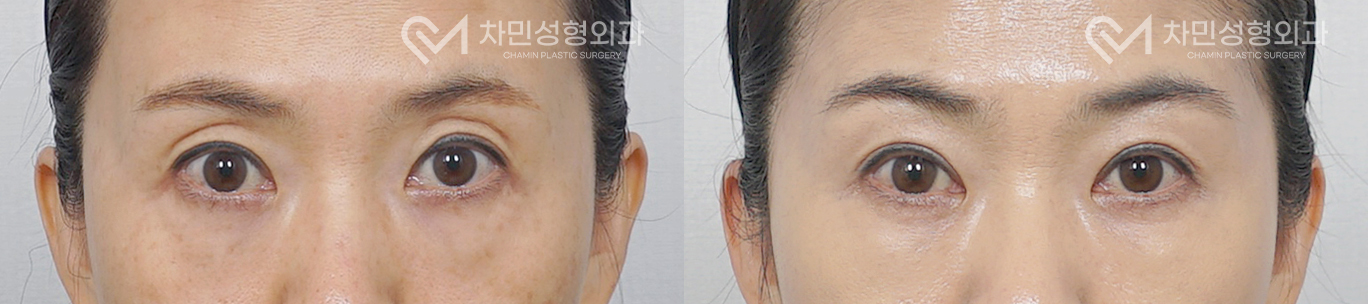 1번째 첨부파일