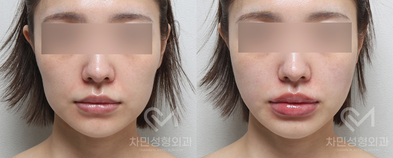 1번째 첨부파일