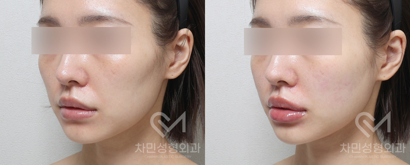 2번째 첨부파일