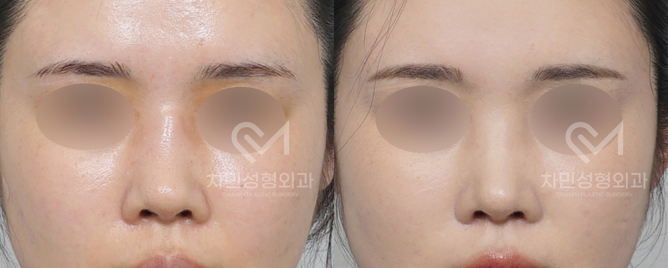 3번째 첨부파일