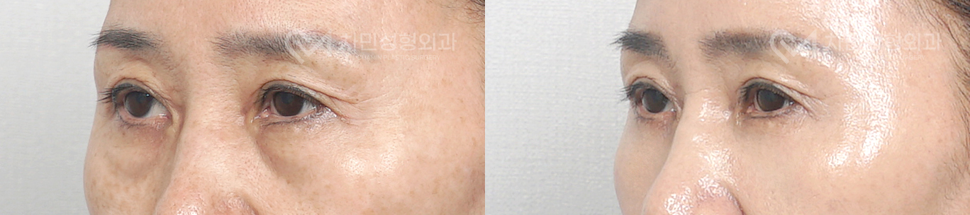 2번째 첨부파일