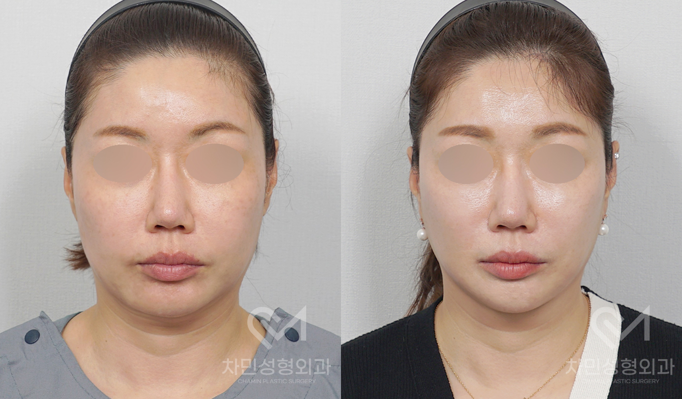 1번째 첨부파일