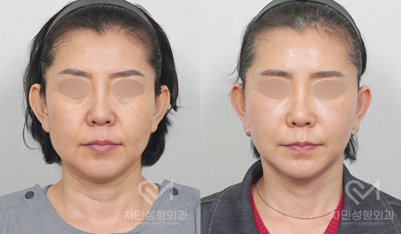 1번째 첨부파일