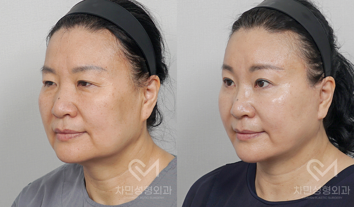 2번째 첨부파일