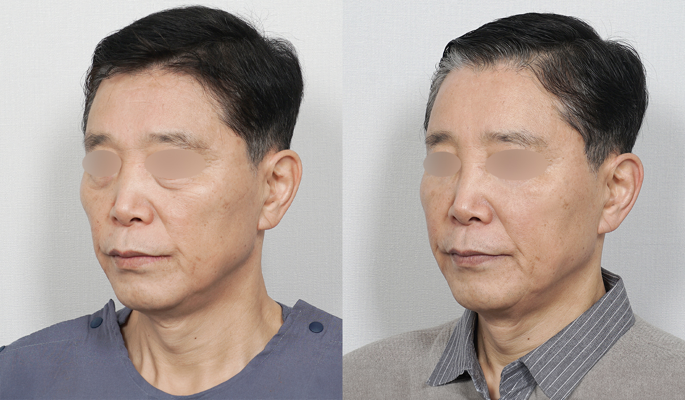 2번째 첨부파일
