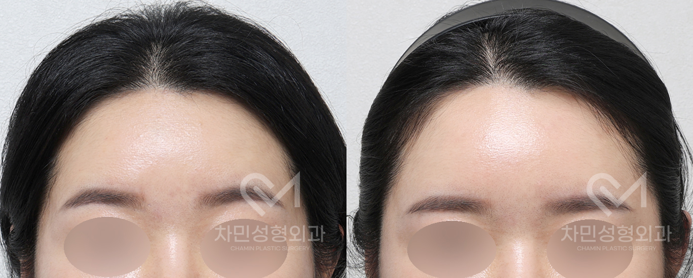 1번째 첨부파일