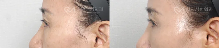 정면