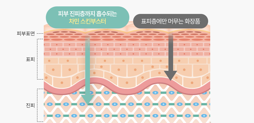 피부 진피층까지 흡수되는 차민 스킨부스터