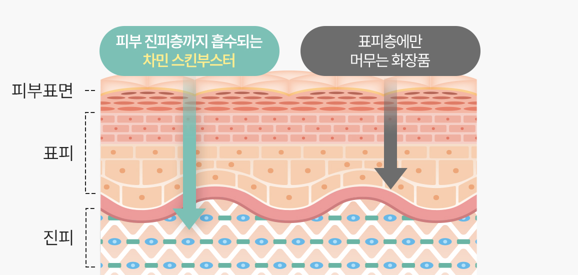 피부 진피층까지 흡수되는 차민 스킨부스터