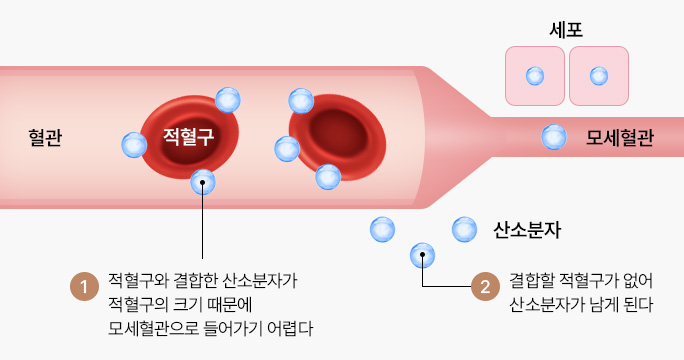 대기 중의 혈관 상태 (1기압)