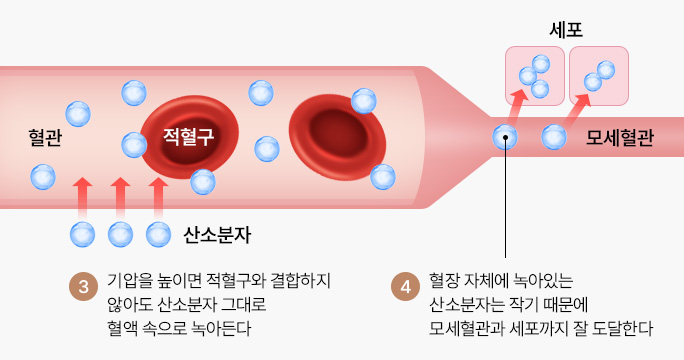 대기 중의 혈관 상태 (1기압)