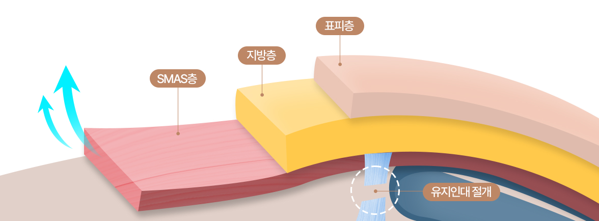 스마스(SMAS)