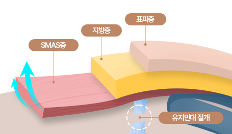 스마스(SMAS)