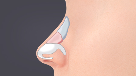 코의 지지구조