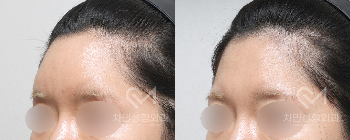 2번째 첨부파일